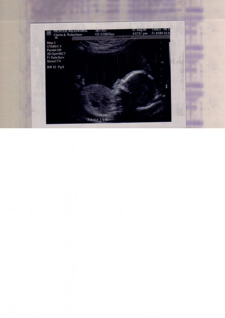 Scan - 19 weeks 4 days